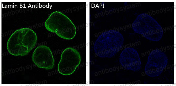Anti-LMNB1 Antibody (R1A03)