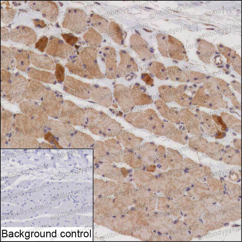 Immunohistochemical for Anti-NEB Antibody (R3F78) ?>
