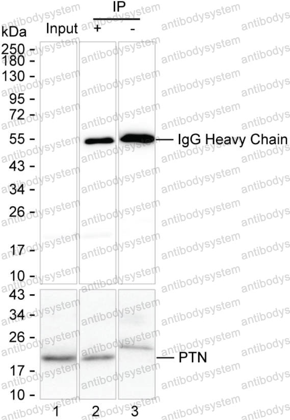 Immunoprecipitation for Anti-PTN Antibody (R3F83) ?>