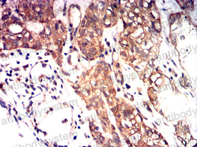 Immunohistochemical for Anti-KITLG/SCF Antibody (R3F87) ?>