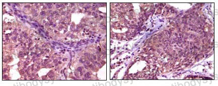 Immunohistochemical for Anti-EPHA1 Antibody (R3F91) ?>