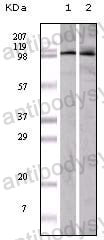 Western blot for Anti-EPHA1 Antibody (R3F91) ?>