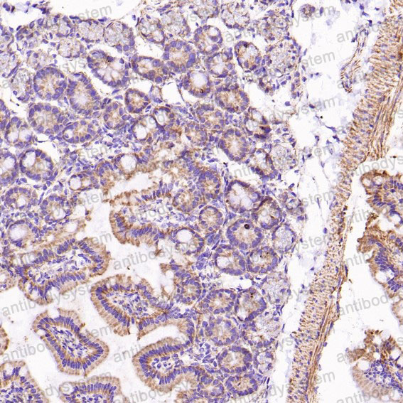 Anti-VDAC1 Antibody (R1B62)