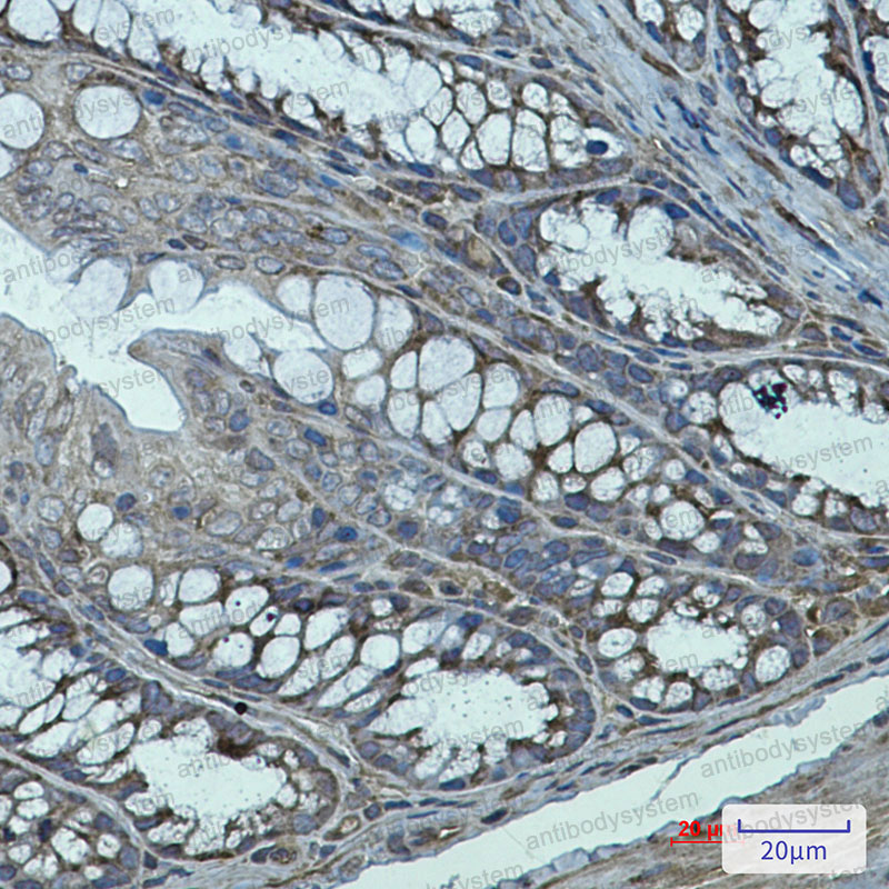 Anti-TGM2 Antibody (R1R92)