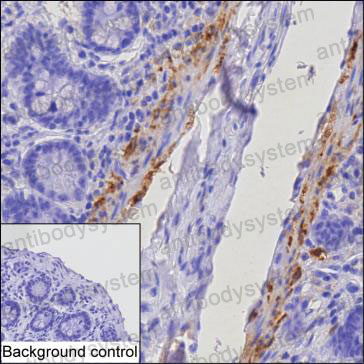Immunohistochemical for Anti-TGM2 Antibody (R3G03) ?>