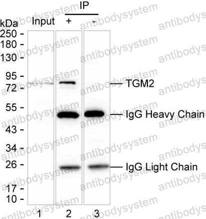 Immunoprecipitation for Anti-TGM2 Antibody (R3G03) ?>