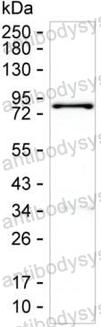 Western blot for Anti-TGM2 Antibody (R3G03) ?>