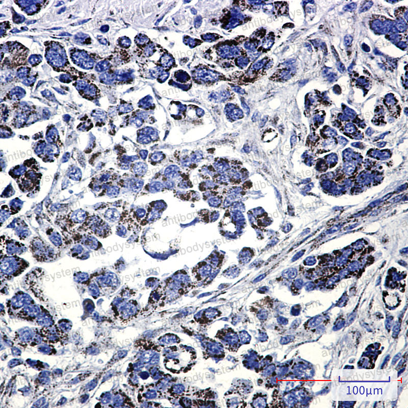 Anti-MMUT Antibody (R1R96)