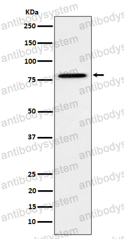 Anti-MMUT Antibody (R1R94)
