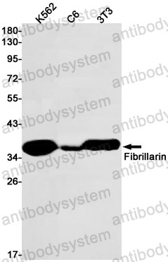 Anti-FBL Antibody (R1R97)