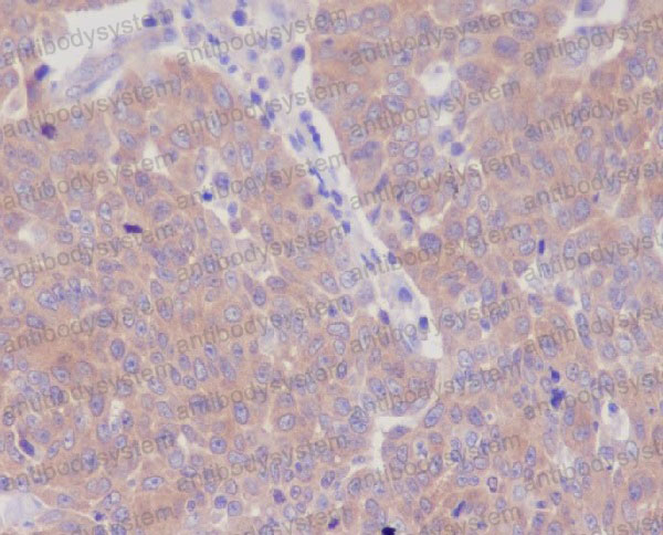 Anti-GART Antibody (R1R98)