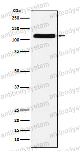 Anti-UBA1 Antibody (R1S02)