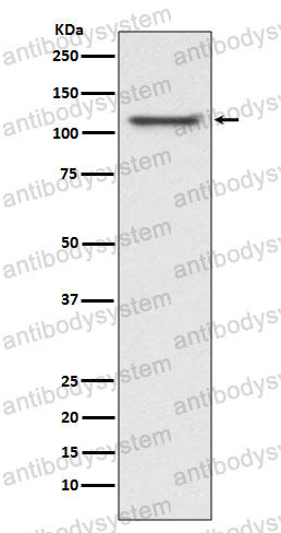 Anti-UBA1 Antibody (R1S01)