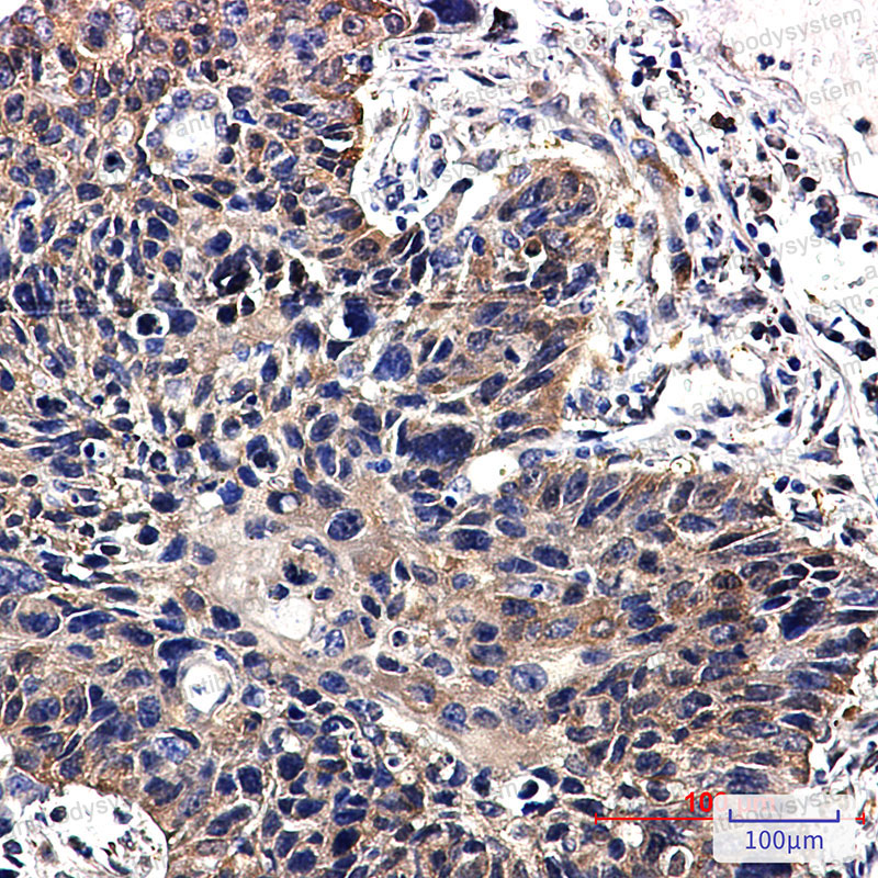 Anti-NME2 Antibody (R1S03)