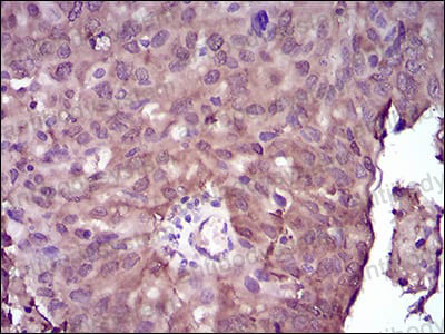 Anti-NME2 Antibody (R3G10)