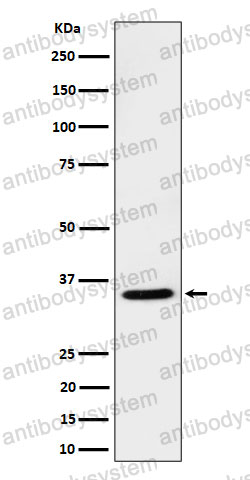 Anti-USF1 Antibody (R1S04)