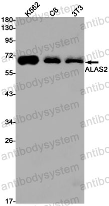 Anti-ALAS2 Antibody (R1S06)