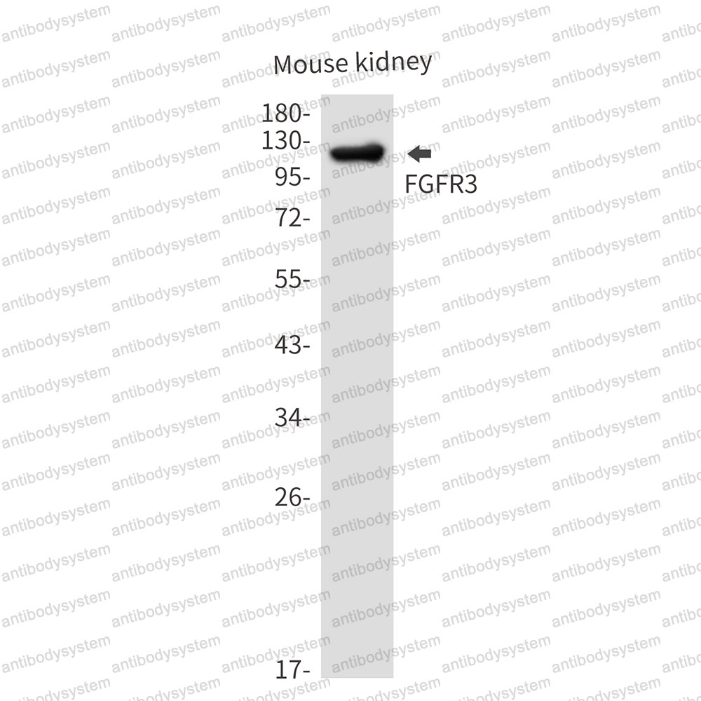 Anti-CD333/FGFR3 Antibody (R1S08)