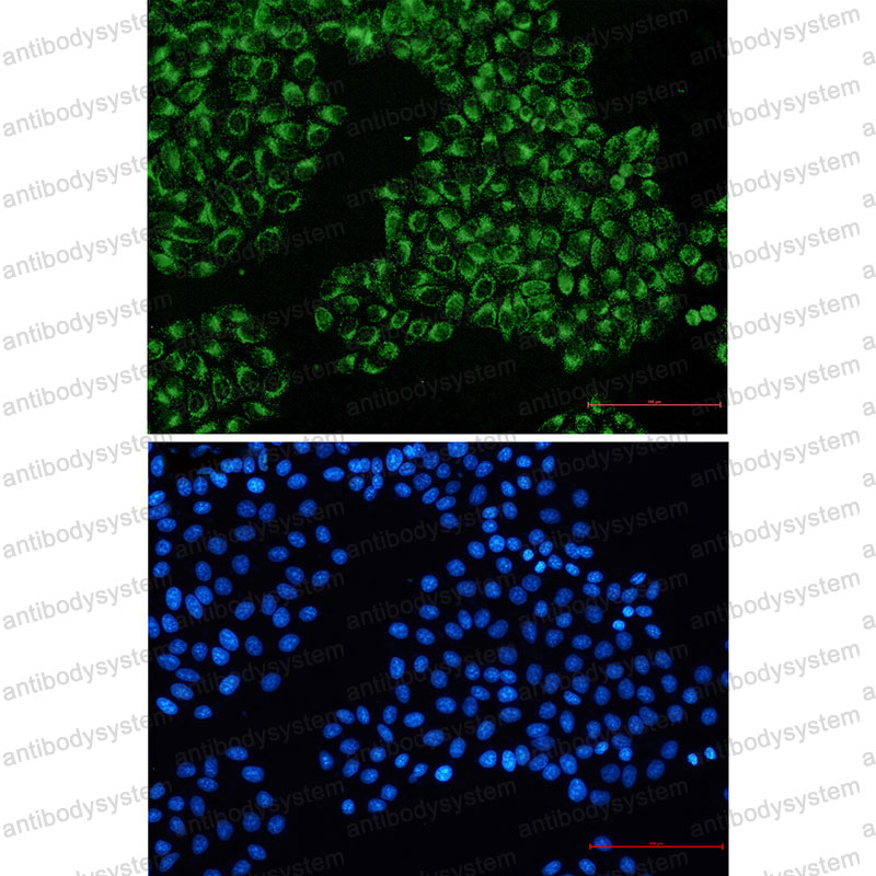 Anti-CD333/FGFR3 Antibody (R1S07)