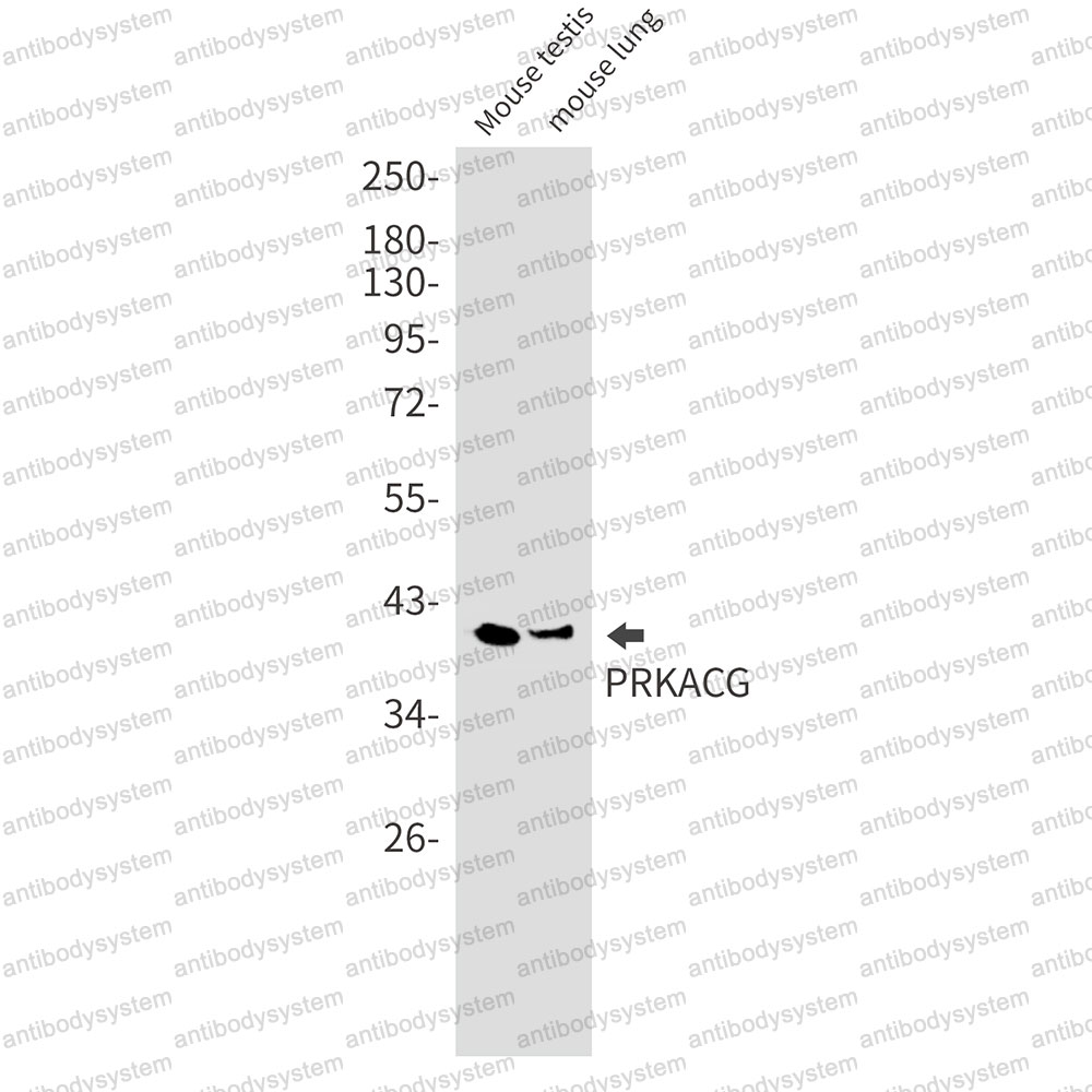 Anti-PRKACG/PKA C gamma Antibody (R1S10)