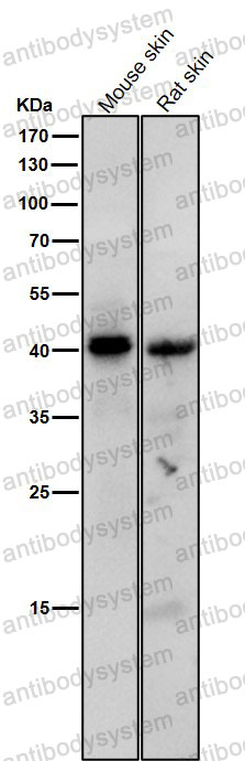 Anti-Phospho-PRKACG (Thr197) Antibody (R1S09)