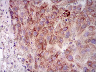 Immunohistochemical for Anti-PRKACG Antibody (R3G17) ?>