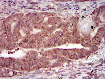 Immunohistochemical for Anti-PRKACG Antibody (R3G17) ?>