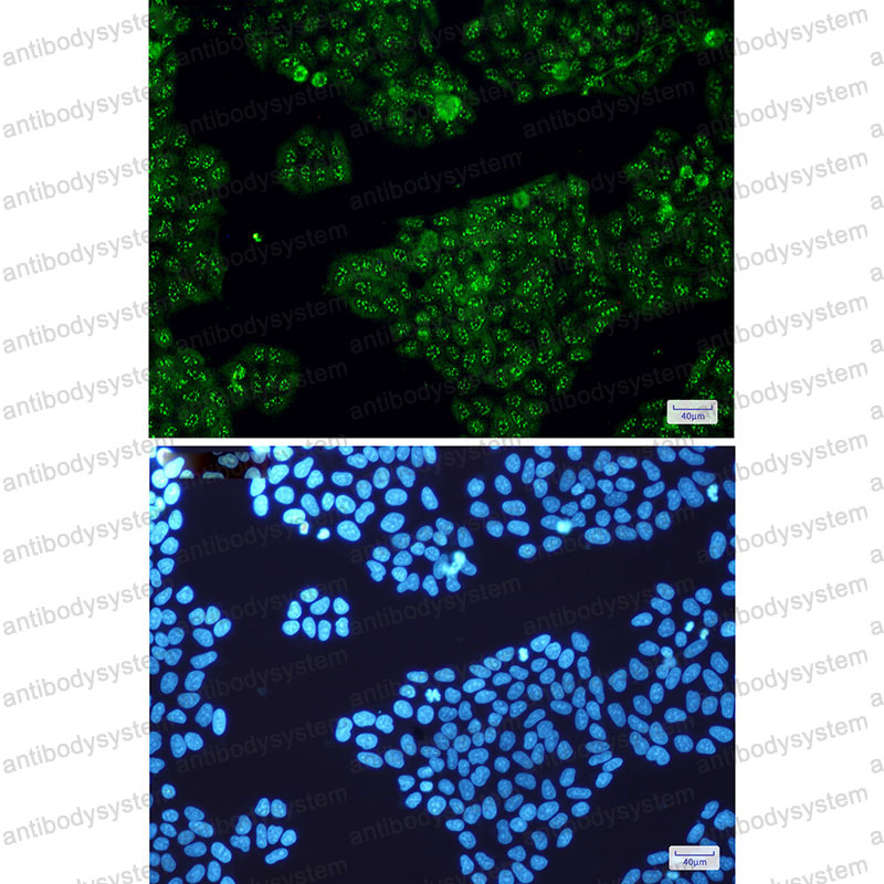 Anti-Calretinin/CALB2 Antibody (R1S11)