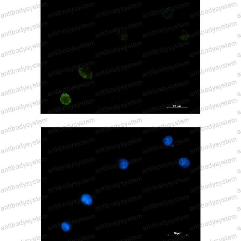 Anti-CBL Antibody (R1S14)
