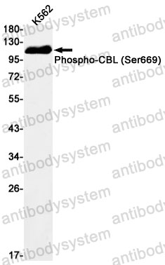 Anti-Phospho-CBL (Ser669) Antibody (R1S13)