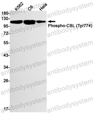 Anti-Phospho-CBL (Tyr774) Antibody (R1S12)