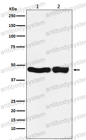 Anti-UQCRC2 Antibody (R1S15)