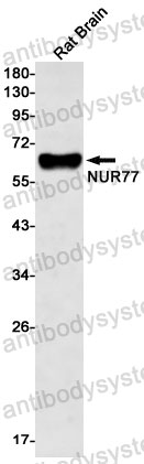 Anti-NR4A1 Antibody (R1S17)