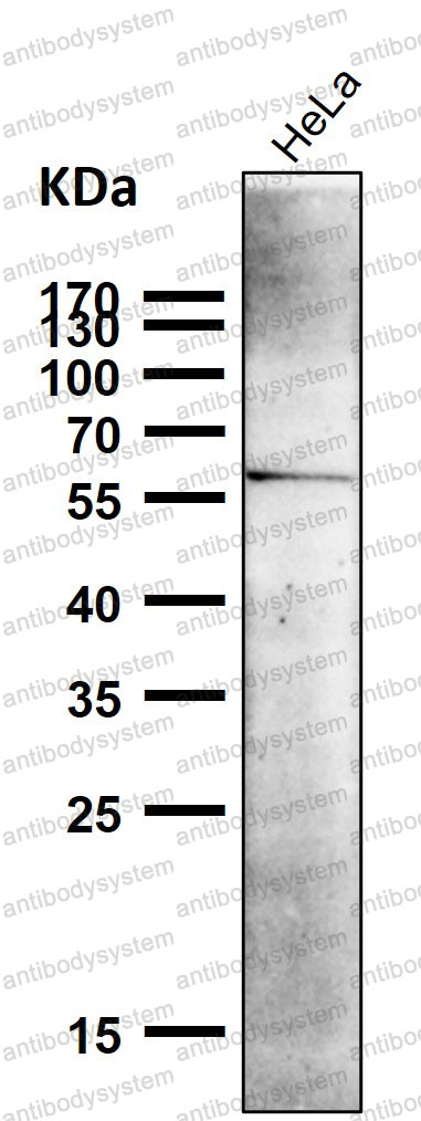 Anti-NR4A1 Antibody (R1S16)