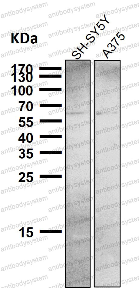 Western blot for Anti-NR4A1 Antibody (R1S16) ?>