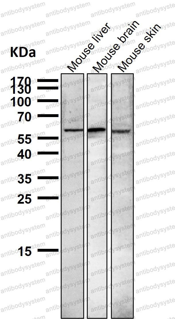 Western blot for Anti-NR4A1 Antibody (R1S16) ?>