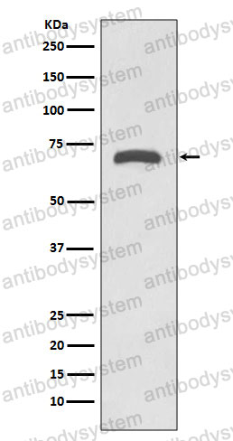 Anti-MMP8 Antibody (R1S18)