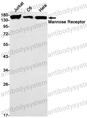 Anti-CD206/MRC1 Antibody (R1S19)