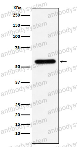 Anti-CES1 Antibody (R1S20)