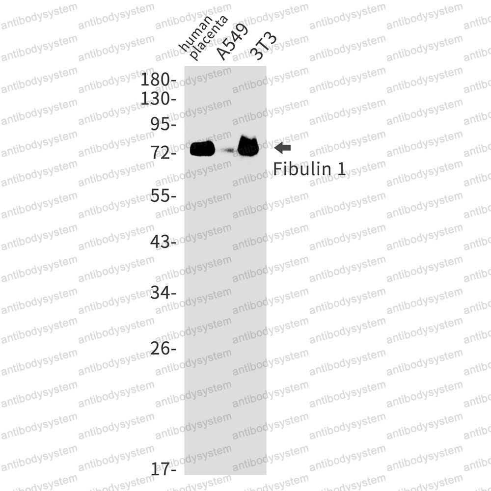 Anti-FBLN1 Antibody (R1S21)