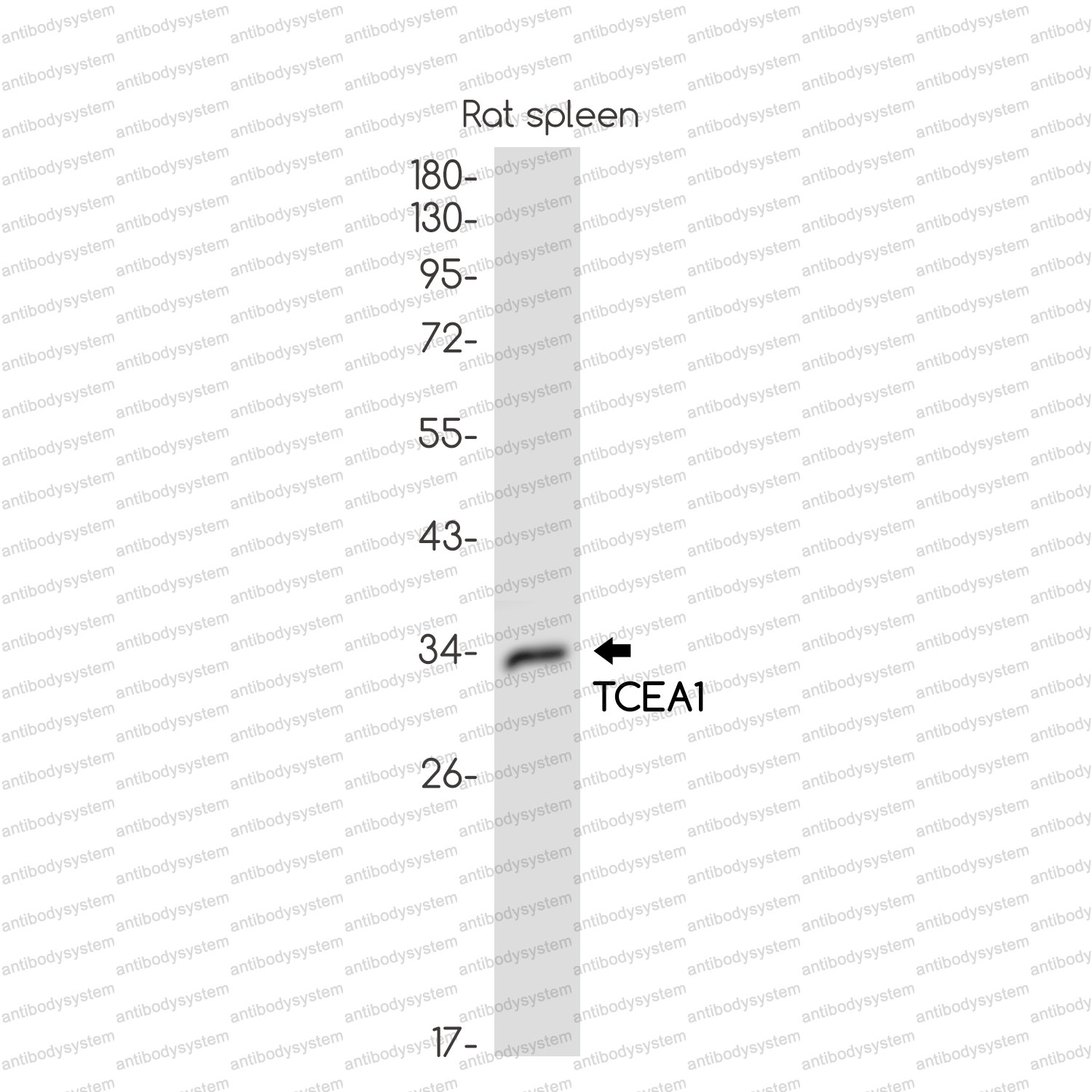 Anti-TCEA1 Antibody (R1S25)