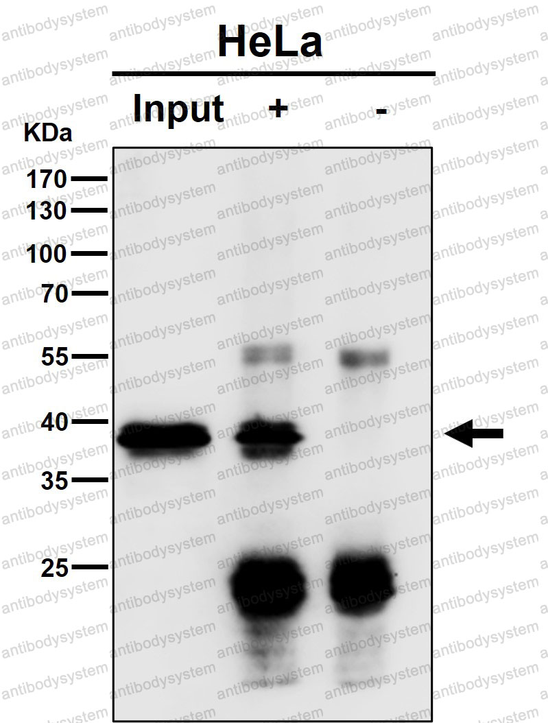Anti-TCEA1 Antibody (R1S22)