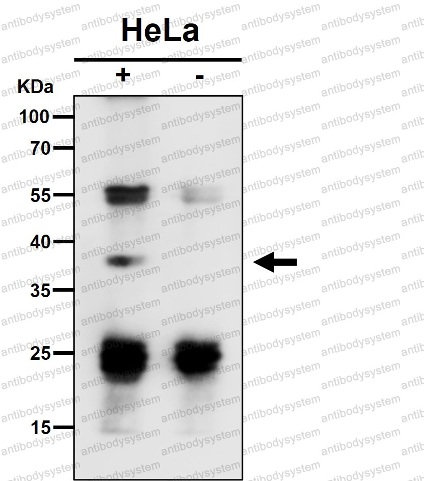 Anti-TCEA1 Antibody (R1S23)