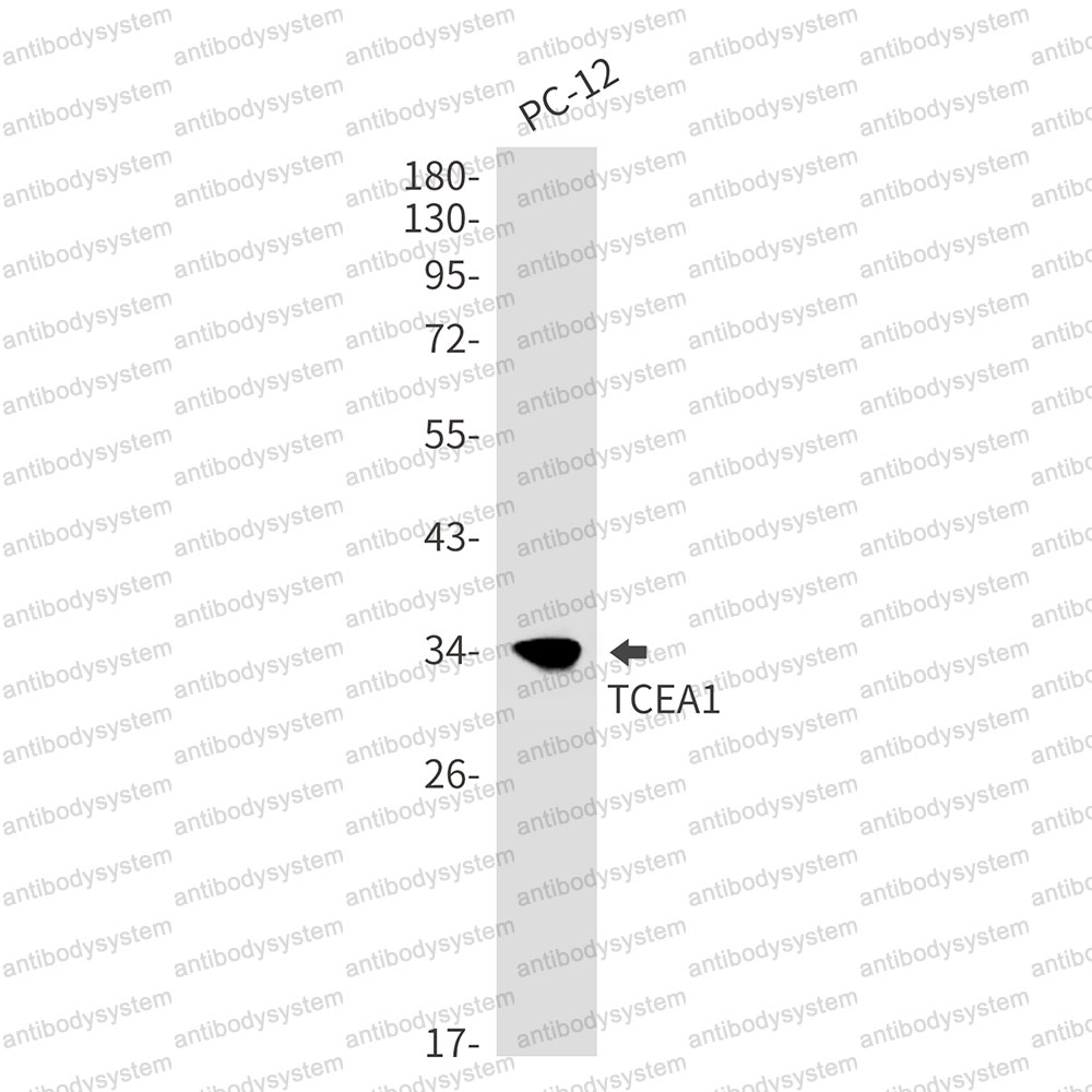 Anti-TCEA1 Antibody (R1S24)