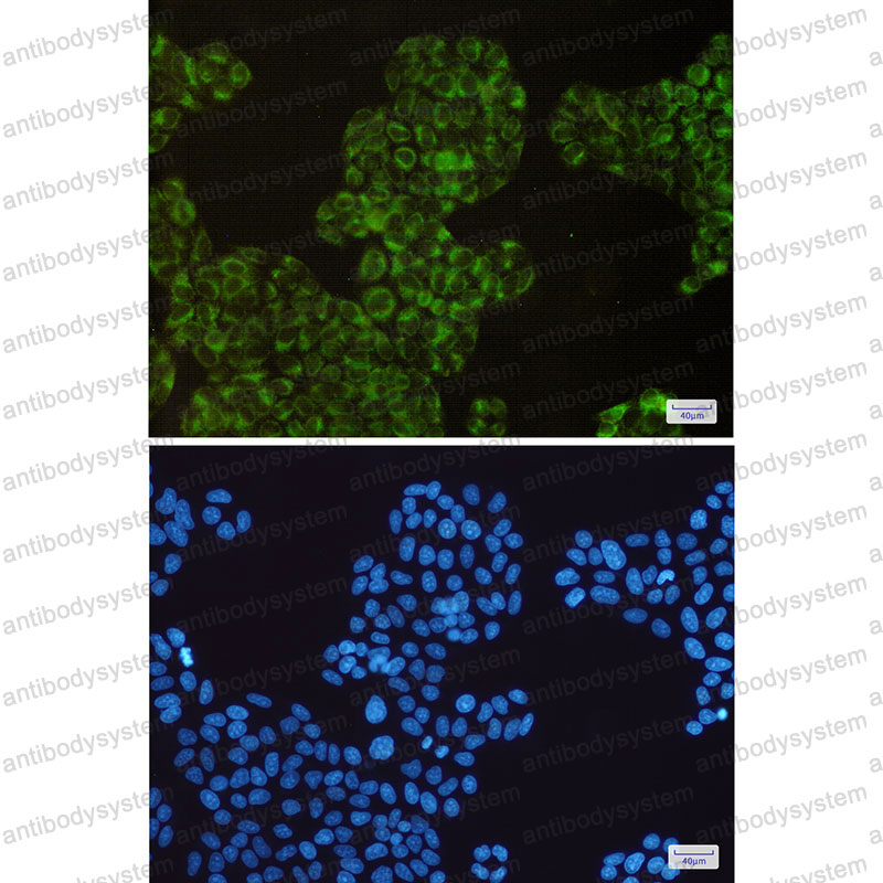 Anti-PTGS1 Antibody (R1S27)