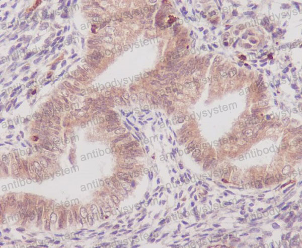 Anti-PTGS1 Antibody (R1S26)