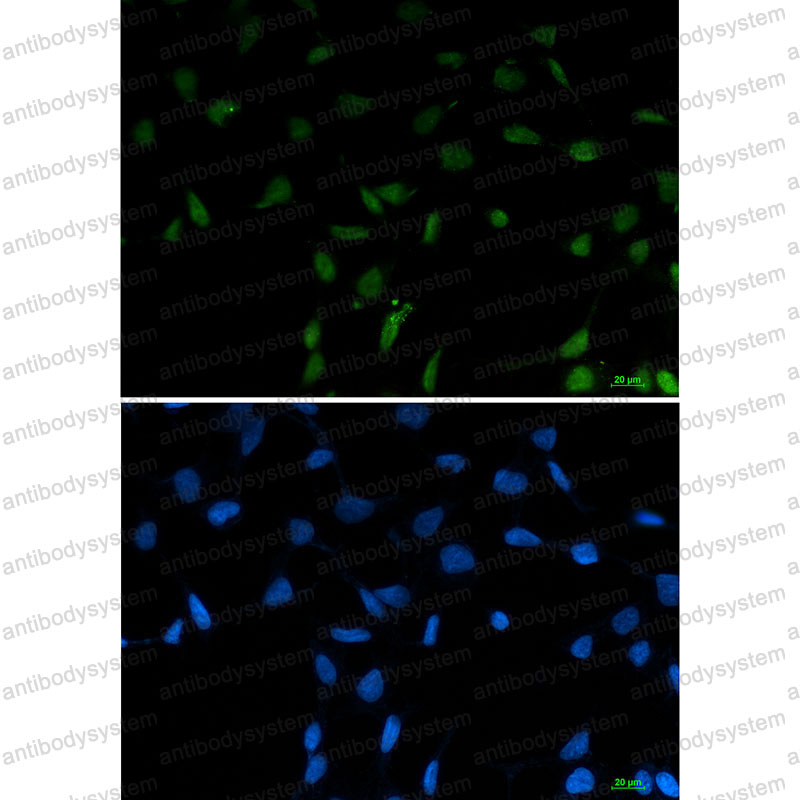 Anti-SFPQ Antibody (R1S29)