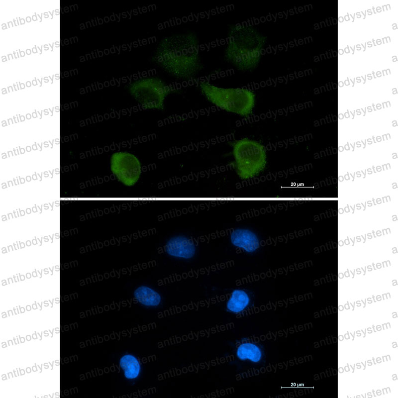 Anti-TUBG1 Antibody (R1S30)