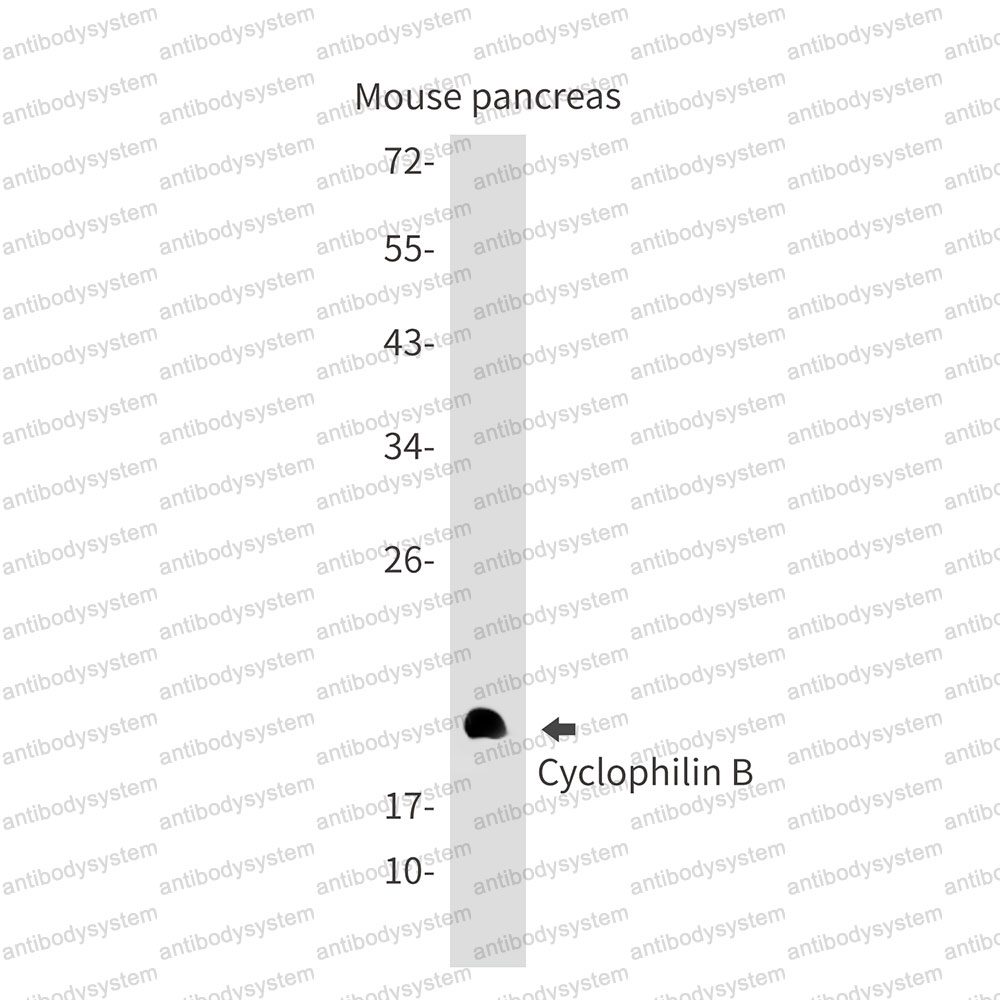 Anti-PPIB Antibody (R1S31)
