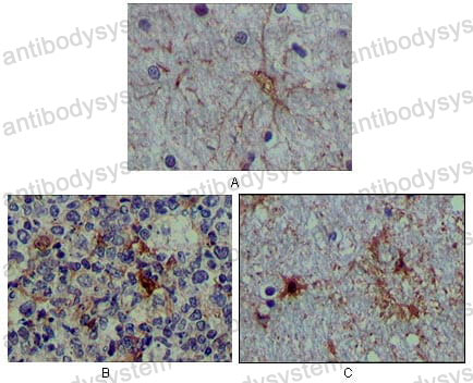 Immunohistochemical for Anti-S100A1 Antibody (R3G31) ?>